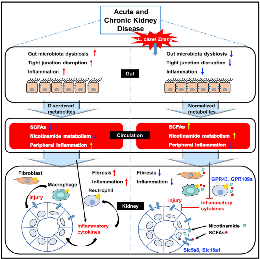 Cell子刊：益生菌可减缓急性和慢性肾脏疾病进展