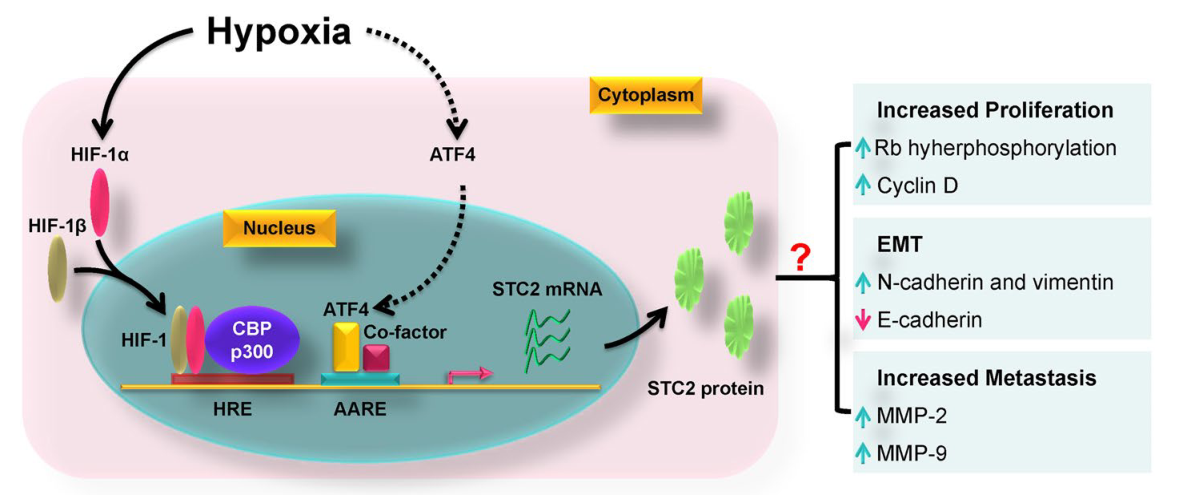 STC2：一种通用的肿瘤生物标志物和潜在的治疗靶点